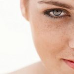 درمان های خانگی برای از بین بردن لکه های تیره صورت