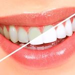 6 روش طبیعی برای سفید کردن دندان‌ها