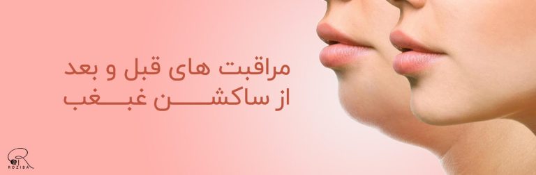 مراقبت های قبل و بعد از ساکشن غبغب