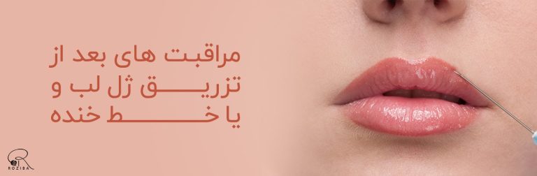 مراقبت های بعد از تزریق ژل لب و یا خط خنده