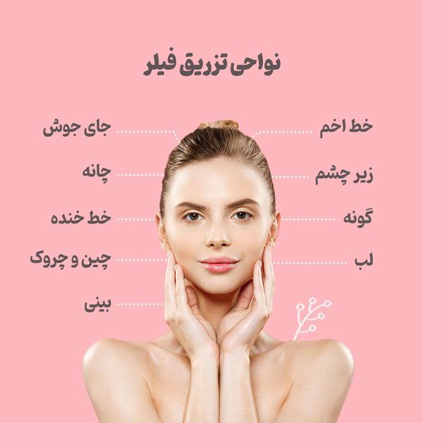 نواحی تزریق فیلر برای هر قسمت از صورت