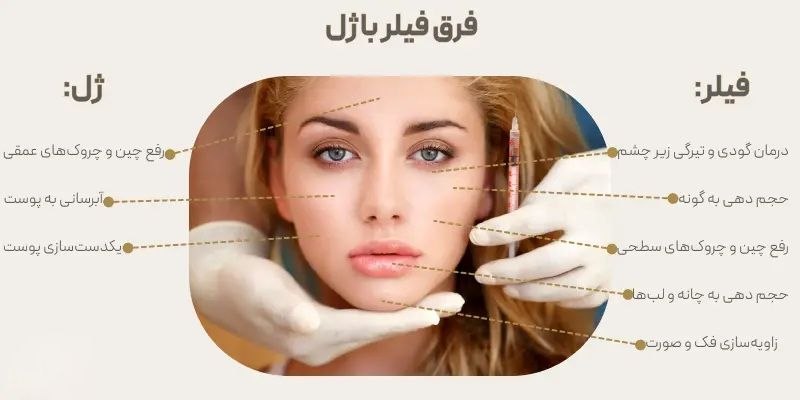 فرق مکان های تزریق فیلر و ژل
